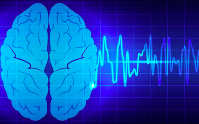 Día Mundial de la Epilepsia